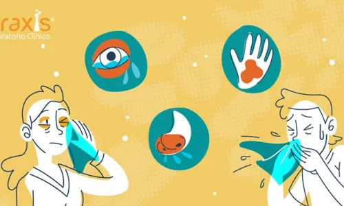 Los-síntomas-de-alergia-más-comunes Los-síntomas-de-alergia-más-comunes